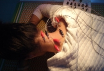 Tác dụng sóng siêu âm trong vật lý trị liệu 