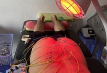 Điện châm điều trị giảm đau