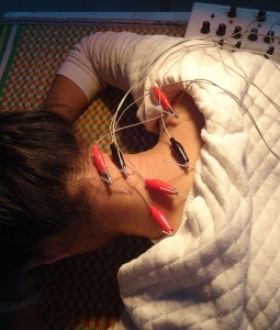 Tác dụng sóng siêu âm trong vật lý trị liệu 