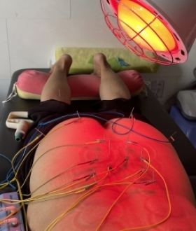 Điện châm điều trị giảm đau